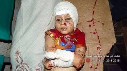 حزب الإصلاح يدين مجزرة الحوثيين في تعز ويطالب باعتبارها جرائم إبادة ويدعو التحالف لفك الحصار عن المدينة (نص البيان)