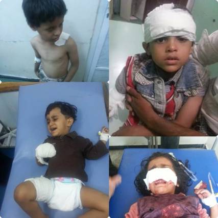 حصيلة معارك السبت في تعز .. مقتل 21 وإصابة 32 من عناصر الحوثي والمليشيات ترتكب مجزرة جديدة ضحاياها أطفال