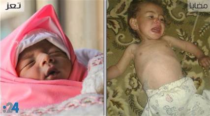 بالصور: من مضايا إلى تعز.. موت واحد بتوقيع إيراني